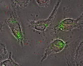 Legionella bacteria
