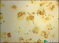 Legionella