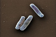 Legionella4