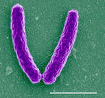 Legionella
