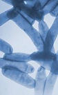 Legionella